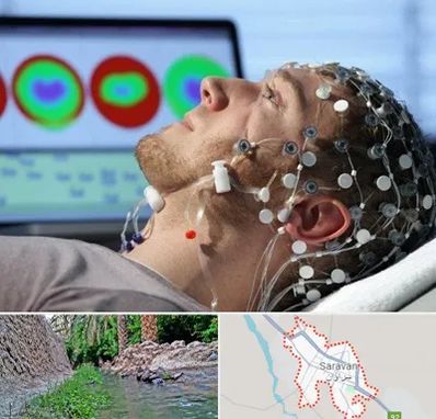 مرکز نوار مغز در سراوان