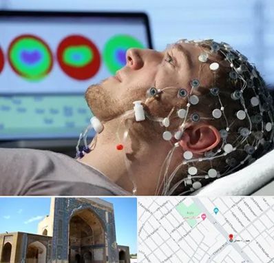 مرکز نوار مغز در مصلی مشهد