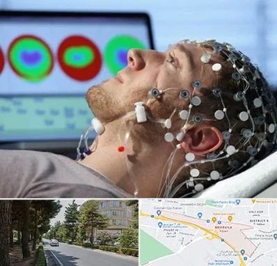 مرکز نوار مغز در مهرویلا کرج 