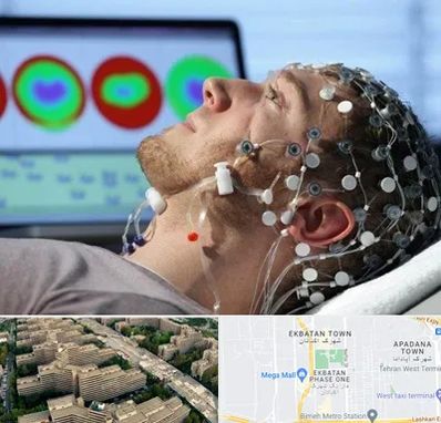 مرکز نوار مغز در اکباتان 