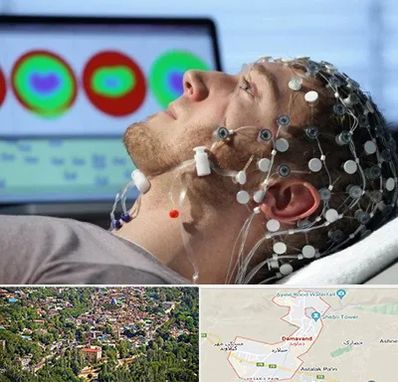 مرکز نوار مغز در دماوند