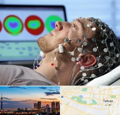 مرکز نوار مغز در غرب تهران 