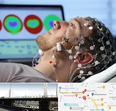 مرکز نوار مغز در پارک وی 