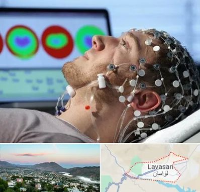 مرکز نوار مغز در لواسان