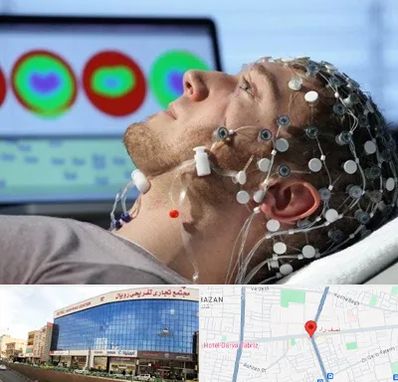 مرکز نوار مغز در نصف راه تبریز