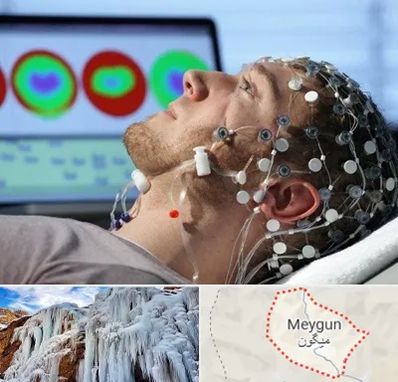 مرکز نوار مغز در میگون