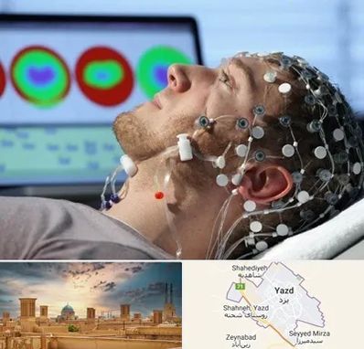 مرکز نوار مغز در یزد