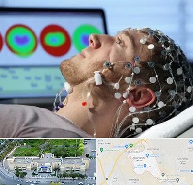 مرکز نوار مغز در نسیم شهر