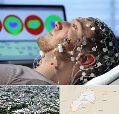 مرکز نوار مغز در شاهرود