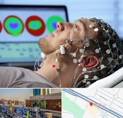 مرکز نوار مغز در لاله پارک تبریز