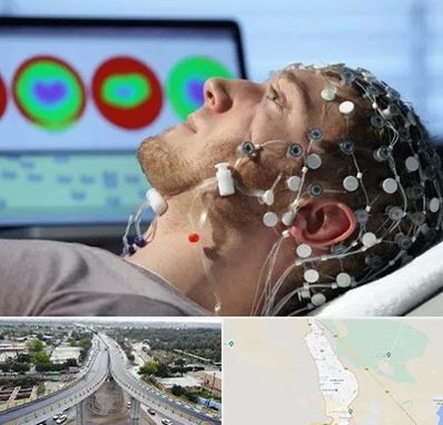 مرکز نوار مغز در اندیمشک