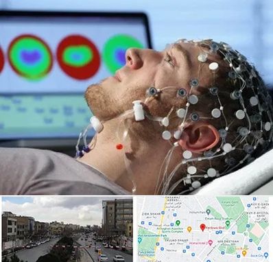 مرکز نوار مغز در بلوار فردوسی مشهد 