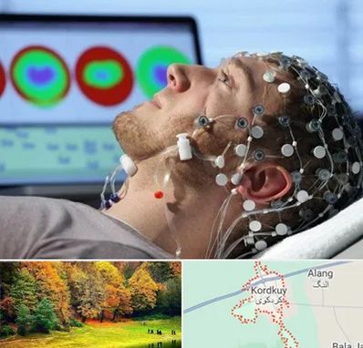 مرکز نوار مغز در کردکوی
