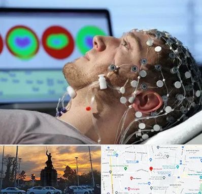 مرکز نوار مغز در میدان حر 