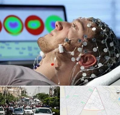 مرکز نوار مغز در سیدی مشهد