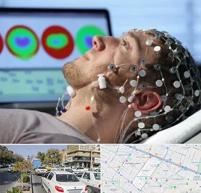 مرکز نوار مغز در مفتح مشهد 