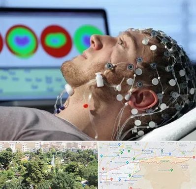 مرکز نوار مغز در منطقه 13 تهران 