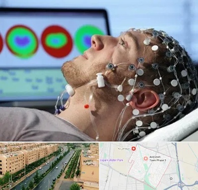 مرکز نوار مغز در فاز سه اندیشه