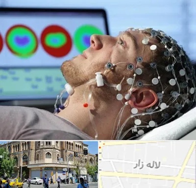 مرکز نوار مغز در لاله زار
