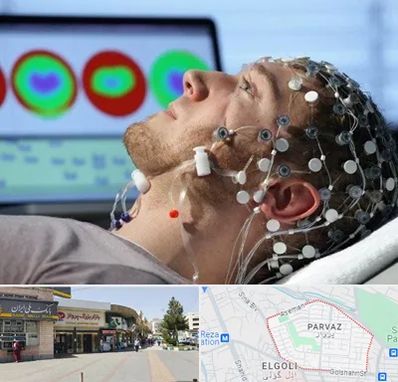 مرکز نوار مغز در پرواز تبریز