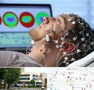 مرکز نوار مغز در طالقانی 