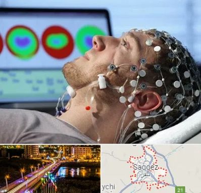 مرکز نوار مغز در سقز