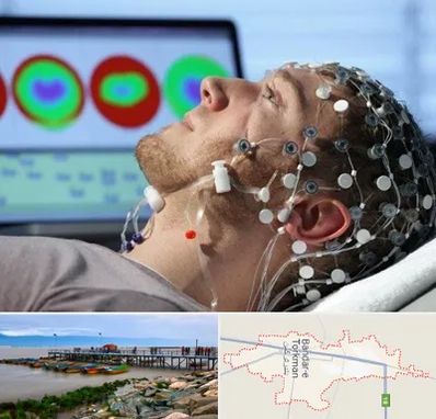 مرکز نوار مغز در بندر ترکمن