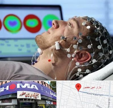 مرکز نوار مغز در امین حضور