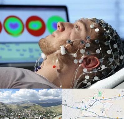 مرکز نوار مغز در رودهن