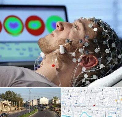 مرکز نوار مغز در ضیابری رشت 