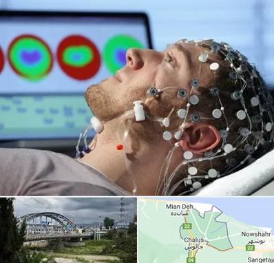 مرکز نوار مغز در چالوس