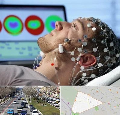 مرکز نوار مغز در احمدآباد مشهد 