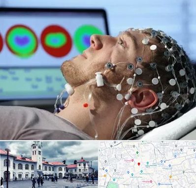 مرکز نوار مغز در میدان شهرداری رشت 