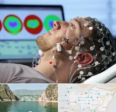 مرکز نوار مغز در ایلام