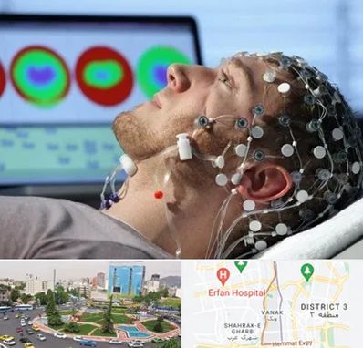 مرکز نوار مغز در ونک 