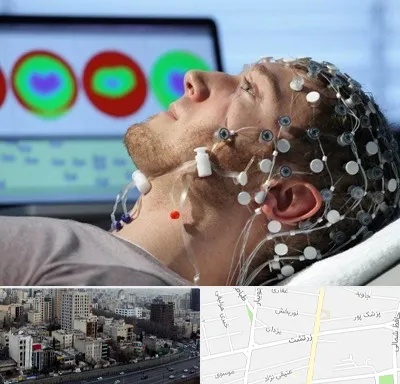 مرکز نوار مغز در زرتشت