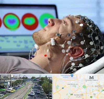 مرکز نوار مغز در جنوب تهران 