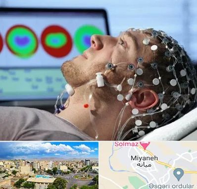 مرکز نوار مغز در میانه