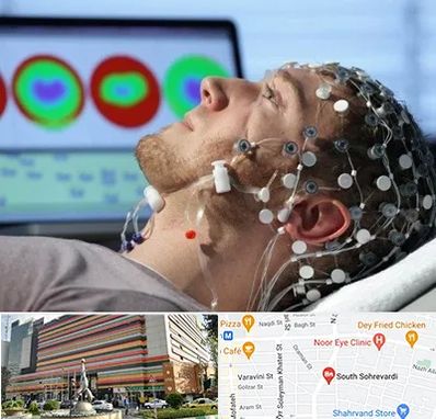 مرکز نوار مغز در سهروردی 