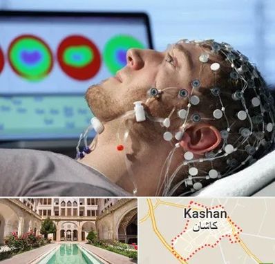 مرکز نوار مغز در کاشان