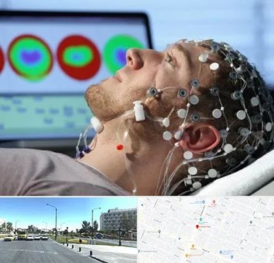 مرکز نوار مغز در بلوار کلاهدوز مشهد 