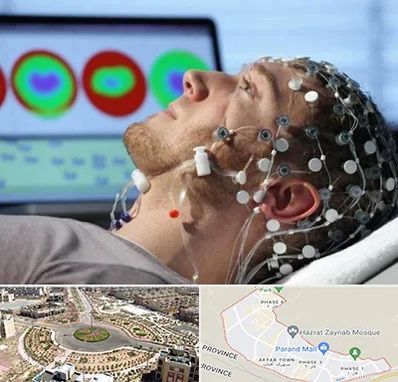 مرکز نوار مغز در پرند