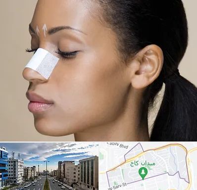 دکتر جراح بینی خانم در سعادت آباد 