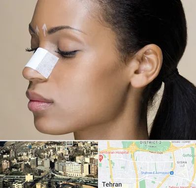 دکتر جراح بینی خانم در مرزداران 