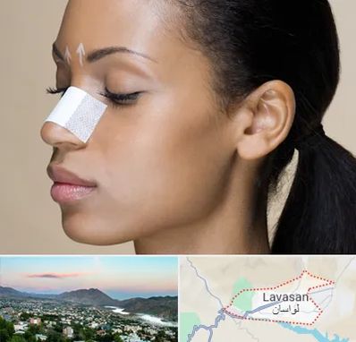 دکتر جراح بینی خانم در لواسان