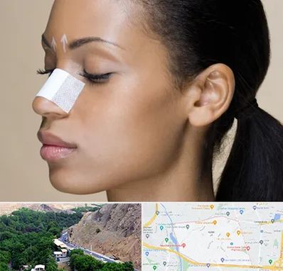 دکتر جراح بینی خانم در کن 