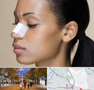 دکتر جراح بینی خانم در ولیعصر ارومیه