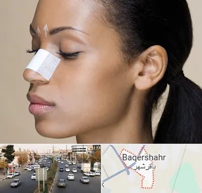 دکتر جراح بینی خانم در باقرشهر