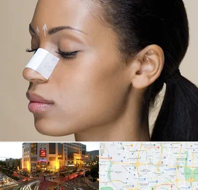 دکتر جراح بینی خانم در جنت آباد تهران 