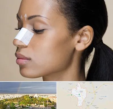 دکتر جراح بینی خانم در تربت حیدریه